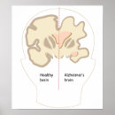 Suche nach nervenzelle poster Anatomie