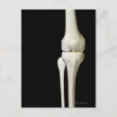 Recherche de genou cartes postales Médical