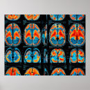 Recherche de neurosciences posters Médecine