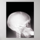 Recherche de radiologue posters Médecin
