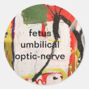 Recherche de foetus Imprimer