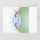 Recherche de chirurgie cartes postales Médical