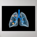 Suche nach hohlraum poster Gesundheitswesen