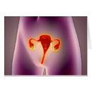 Suche nach menschliche organe postkarten Horizontale