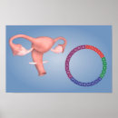 Recherche de médecine interne posters Organes reproducteurs