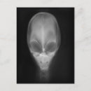 Recherche de rayons x cartes postales Xray