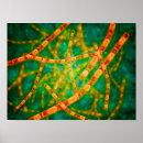 Recherche de pathologie art Grossissement