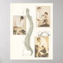 Recherche de vertébral posters Chiropratique