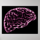 Suche nach xray poster Röntgenbild