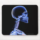 Suche nach röntgenstrahl mousepads Menschlich