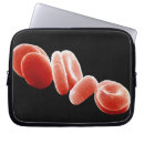 Suche nach biologie laptop schutzhüllen Falsche farbe