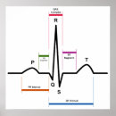 Suche nach ekg poster Elektrokardiogramm
