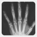 Suche nach röntgen aufkleber Xray