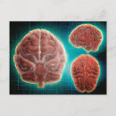 Suche nach menschliches gehirn postkarten Neuroanatomie