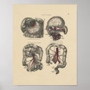 Suche nach menschlicher magen poster Anatomie