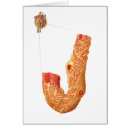 Recherche de membrane cartes postales Médecine