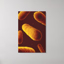 Recherche de pathologie art Répétition