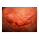 Recherche de foetus cartes postales Embryon