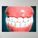 Recherche de illustration dentaire posters Illustrations biomédicales