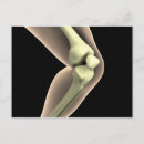 Suche nach knies poster Patella