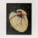 Recherche de diagrammes Coeur