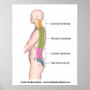 Suche nach wirbelsäule poster Gesundheit