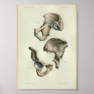 1844 Vintage Anatomie-Druck Beckenknochen Poster