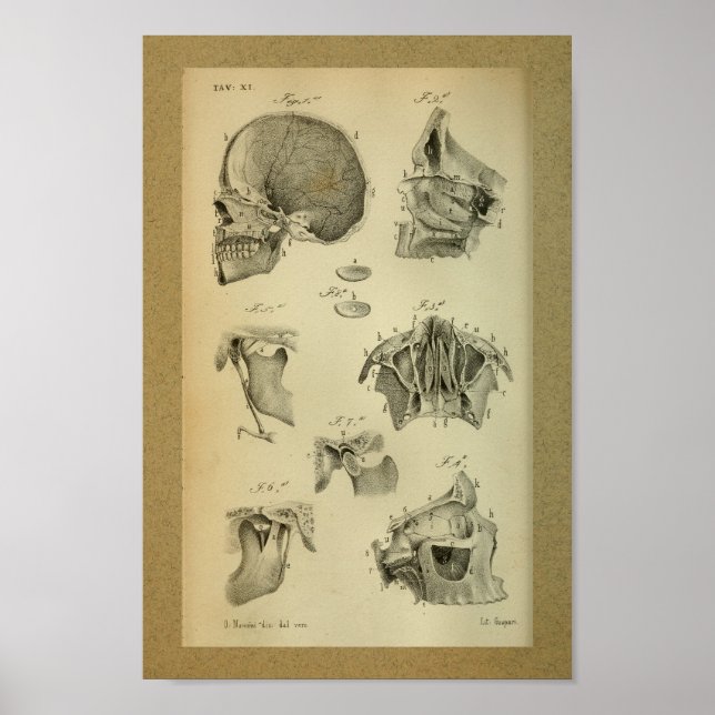 1850 Vintage Anatomie Druckkugel Skull Poster (Vorne)