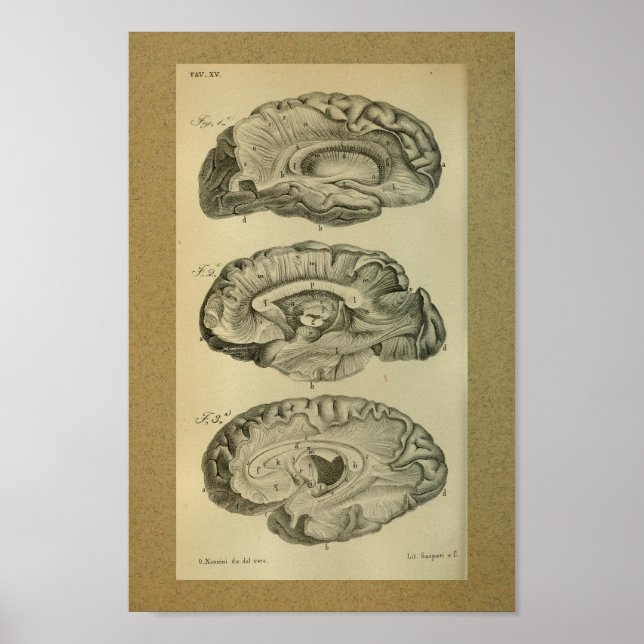 1850 Vintage Anatomie-Gehirnlobes Poster (Vorne)