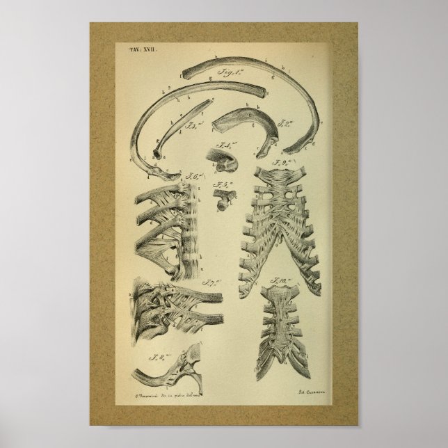1850 Vintager Anatomie Druckkäfig Poster (Vorne)