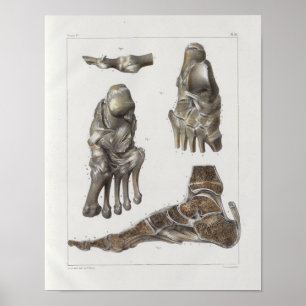 1867 Fußknochen Vintage Anatomie Druck Poster