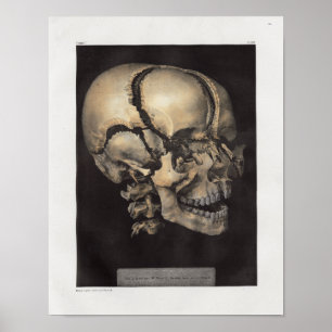 1867 Vintage Anatomie des menschlichen Schädels Poster
