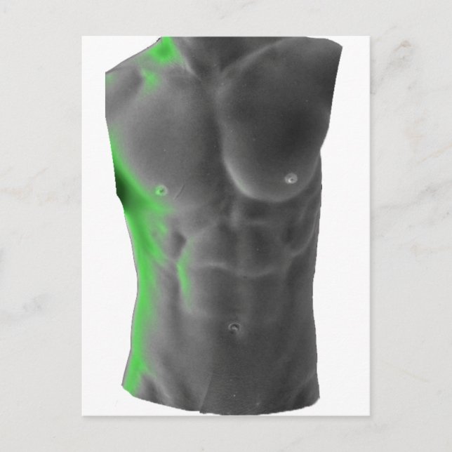 Abs Postkarte (Vorderseite)