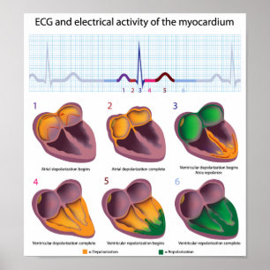 Affiche de l'activité électrique du coeur ECG