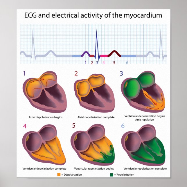 Affiche de l'activité électrique du coeur ECG (Devant)