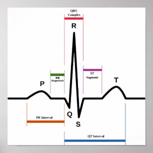Affiche Sinus Rhythm Électrocardiogramme ECG Diagr