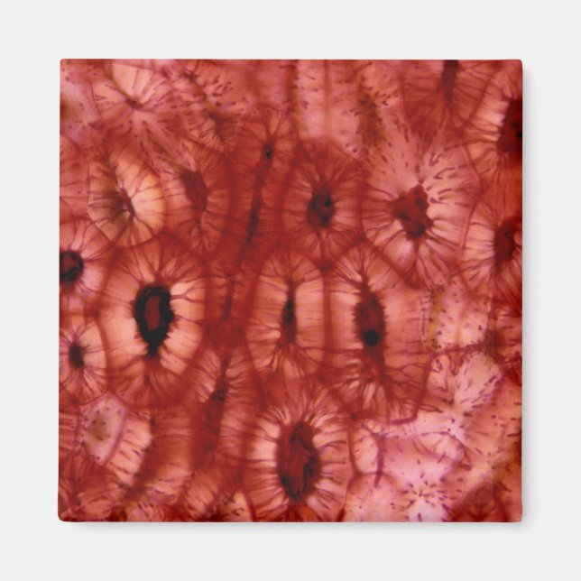 Aimant Cellules de Sclerenchyma d'un cerisier (Devant)