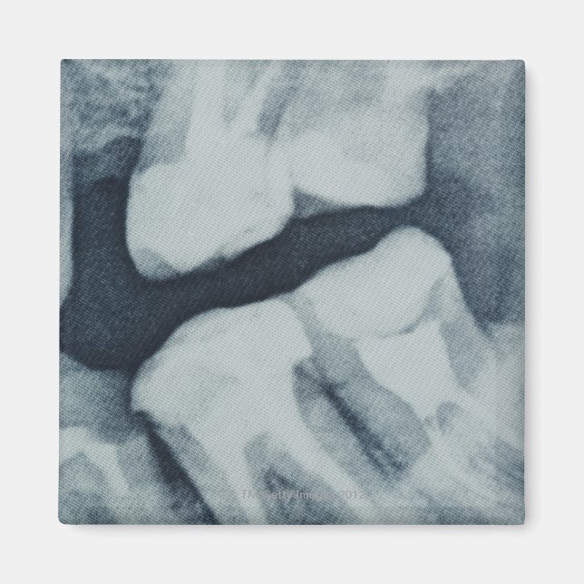 Aimant Gros plan d'une radiographie dentaire (Devant)