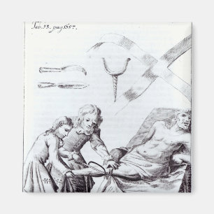 Aimant Opération chirurgicale pour amputer une jambe