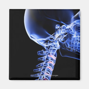 Aimant Radiographiez l'image des os du cou