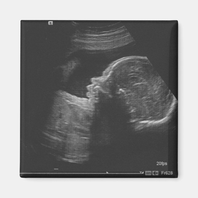 Aimant Ultrasque (Devant)