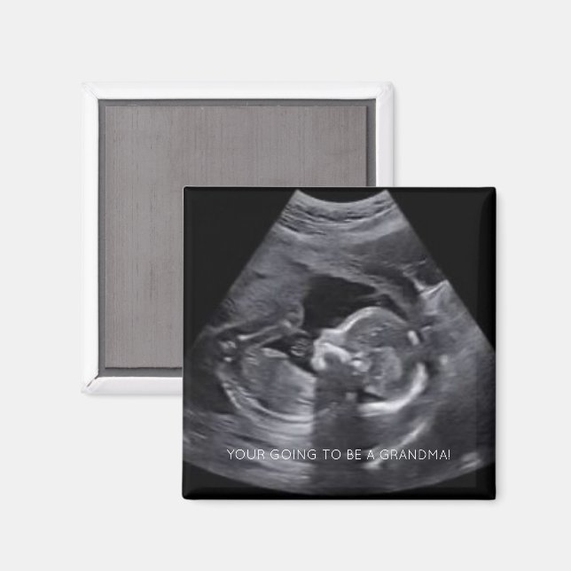 Aimant Vous allez être une GRANDMA Pregnant Sonogramme PH (Recto/Verso)