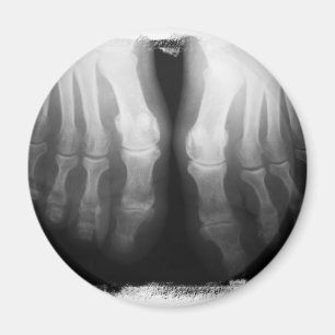 Aimant X-Ray Pieds humains Skeleton Bones noir et blanc