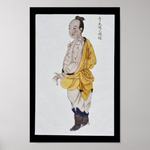 Akupunktur-Dünndarm-Mittagshand Taiyang Poster