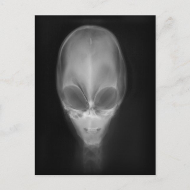Alien Skull Röntgen Postkarte (Vorderseite)