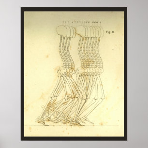 Analyse des Gangbildes Bein Wirbelsäule Chiroprakt Poster
