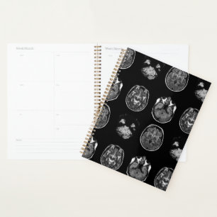 Analyse IRM du cerveau