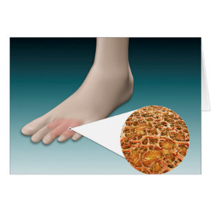 Anatomie de champignon de pied avec le plan