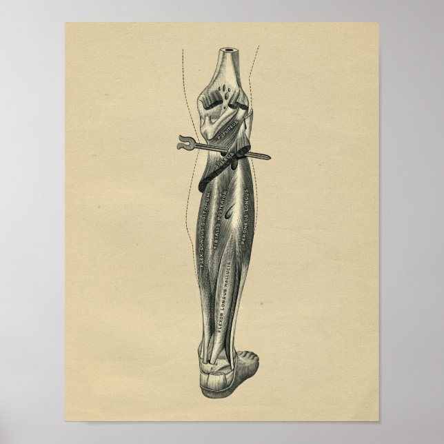 Anatomie de la jambe humaine 1902 Impression Vinta (Devant)