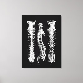 Anatomie der menschlichen Wirbelsäule Große Leinwa Leinwanddruck